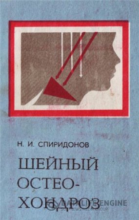 Обложка к Н.И. Спиридонов. Шейный остеохондроз (1983) DjVu